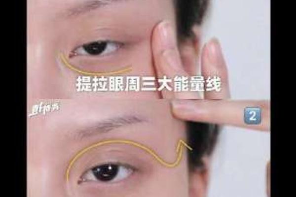 如何有效去除眼睛周围的八字痕