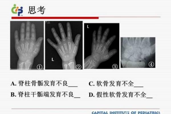 了解八字骨特征：如何判断身体的发育状态