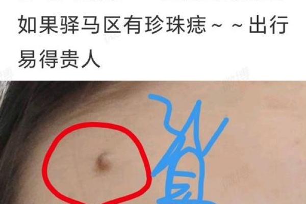 探索痣相中的聪明标志与命运暗示