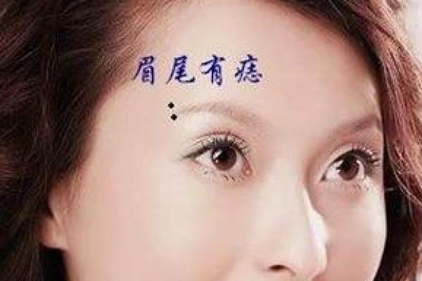痣相水与健康：面部痣的潜在警示信号