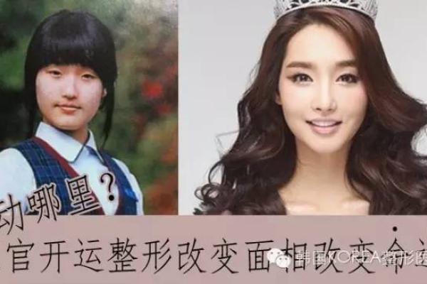 面相整形对职业发展的影响与案例分析