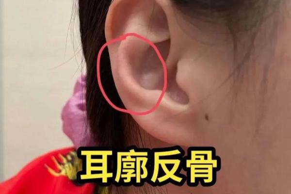 耳朵位置与面相解读：如何通过耳朵判断一个人的运势