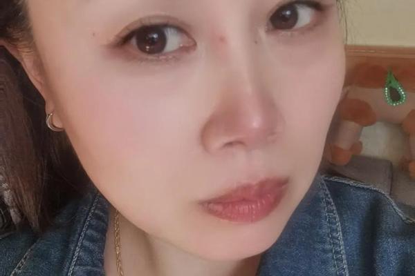 了解肉痣相：不同部位的肉痣暗示着什么