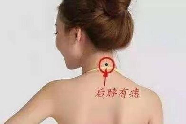 解析痣背相：如何通过背部痣相判断命运