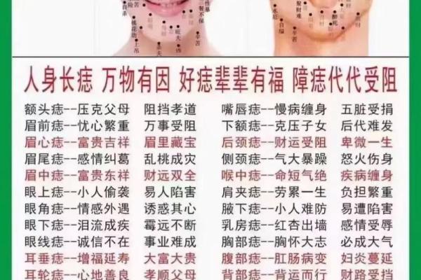 解密神痣：痣相对命运的深刻影响