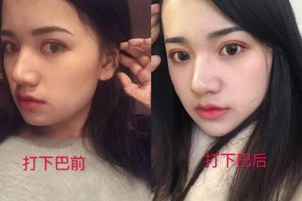 嘴巴歪的面相特征与命运走向的深层关系