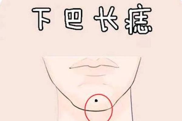 女人痣相背后的玄机：影响命运的微妙痕迹