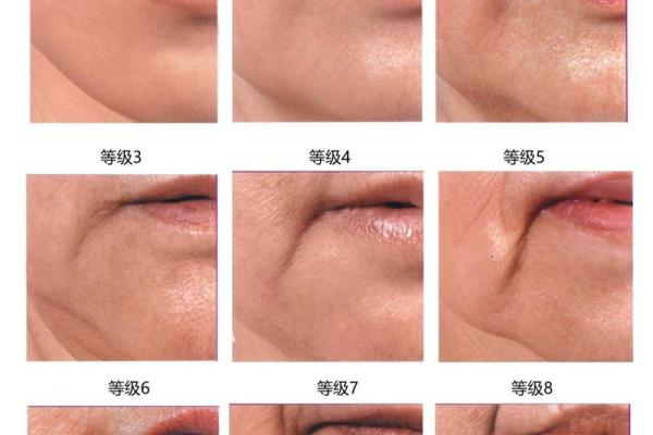 嘴角纹与面相解析：如何影响你的运势与性格特征