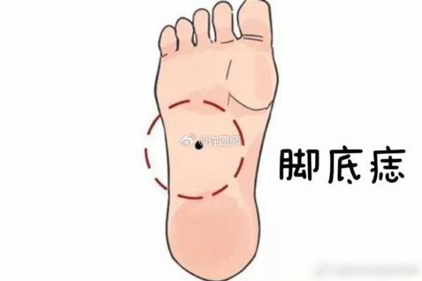痣相脚：从脚底到脚背，揭示个人命运的不同面向