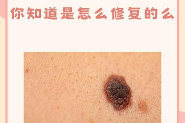 水相痣的危害及早期识别技巧