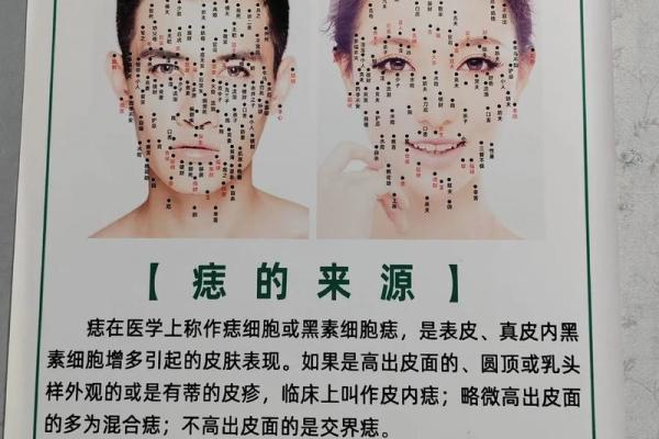 痣相解读：看皮肤上的标记揭示未来
