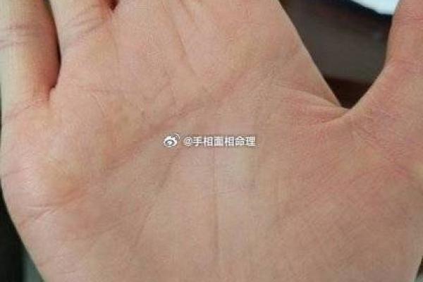 如何通过鸡爪纹手相了解你的个性与未来
