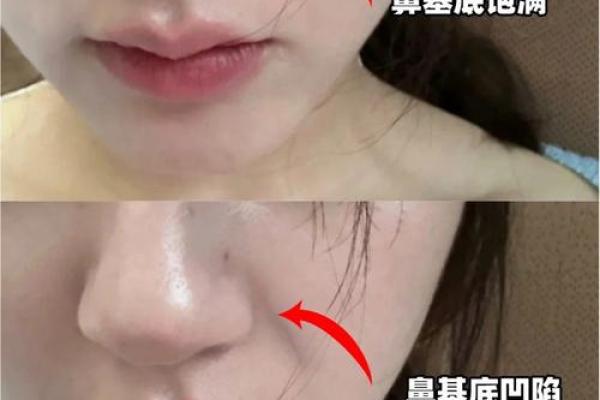 如何通过护肤对抗鼻子八字纹的产生