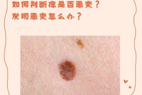 贱痣相：哪些部位的痣可能影响你的财富和爱情