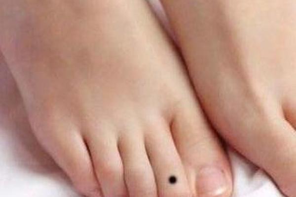 足痣位置解析：你脚上的痣暗示了什么人生轨迹