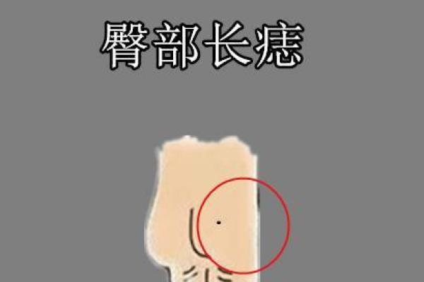 了解手臂痣相，探寻你的命运走向