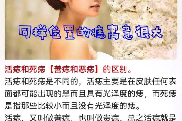 通过痣相预测未来：如何读懂你身体上的痣
