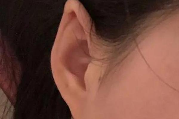 尖耳朵面相如何影响你的生活与人际关系