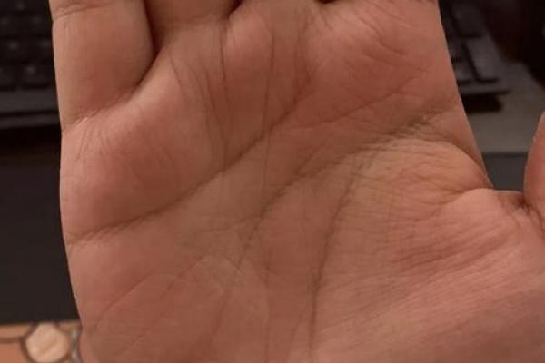 奇迹线在手相中的神奇意义与影响