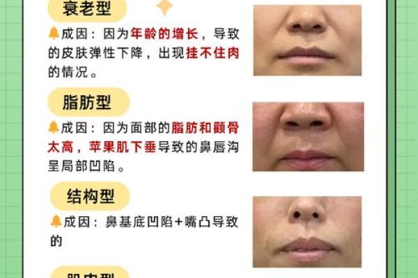 如何有效改善鼻子八字纹的出现与预防方法