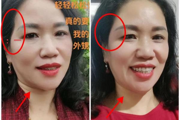 夫妻宫面相解析：如何从面部特征看婚姻运势