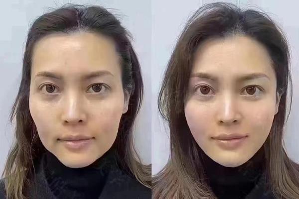 夫妻宫面相分析：如何从面部特征看婚姻运势
