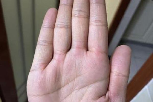 手相分析：流产与孕期不顺的潜在迹象