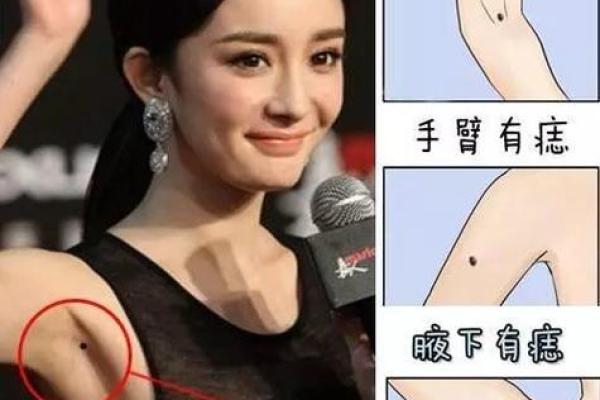翻天覆地的左臂美痣，竟是她命运的转折点