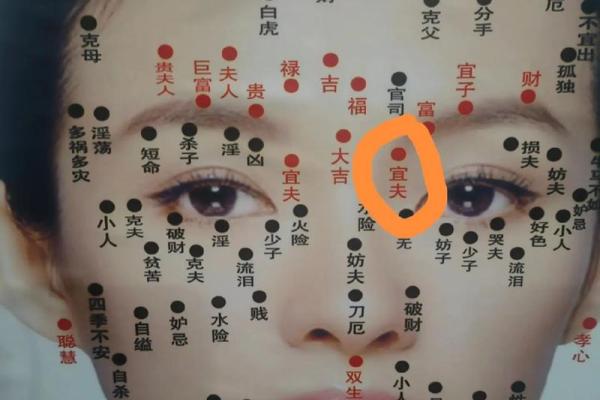 左右脸痣相解读：命运走势一目了然