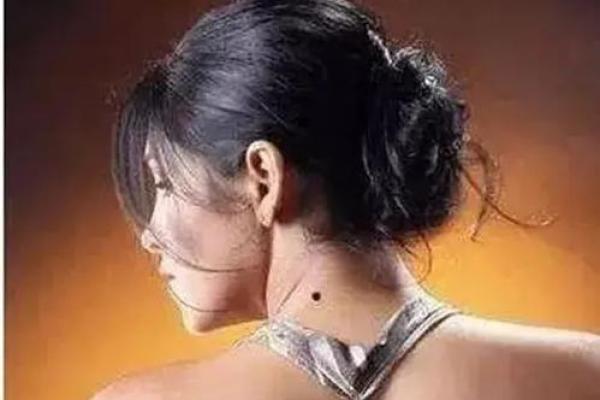 独家解析：女孩颈部痣相背后的命运密码