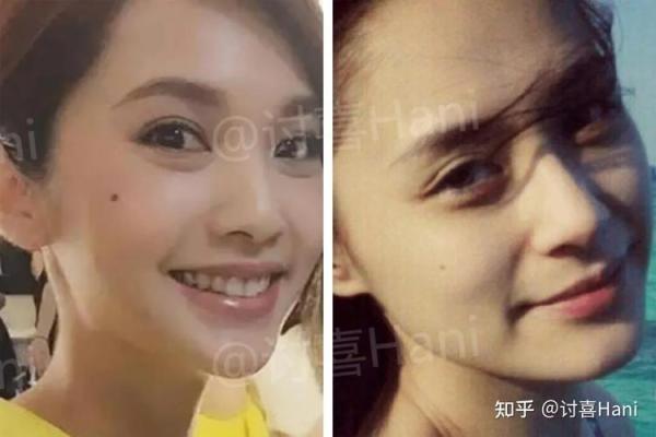 惊艳揭秘左手指痣的神奇寓意