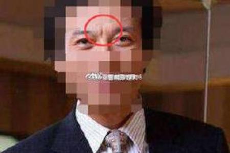 印堂痣的神奇力量：如何影响你的命运？