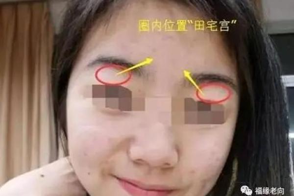 面相揭秘：痘坑多竟影响运势，你的面相还好吗？