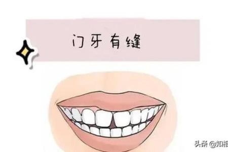 揭秘：门牙长短决定命运，女人门牙面相暗示一生运势必看