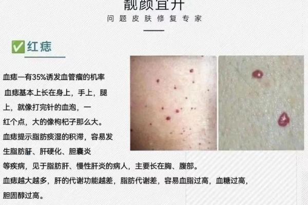 男子红痣独特魅力，揭秘神秘体质
