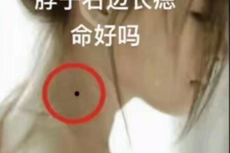 痣在侧面，命运不凡：女性痣相的惊人秘密