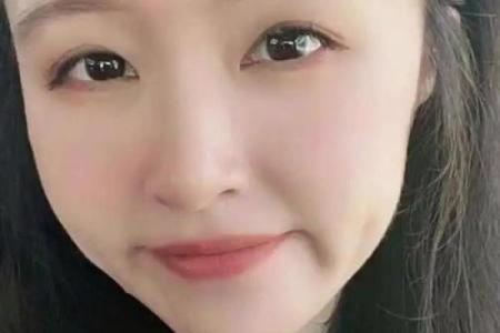 额头痣相：女性运势大揭秘，快来看看你的痣在哪里